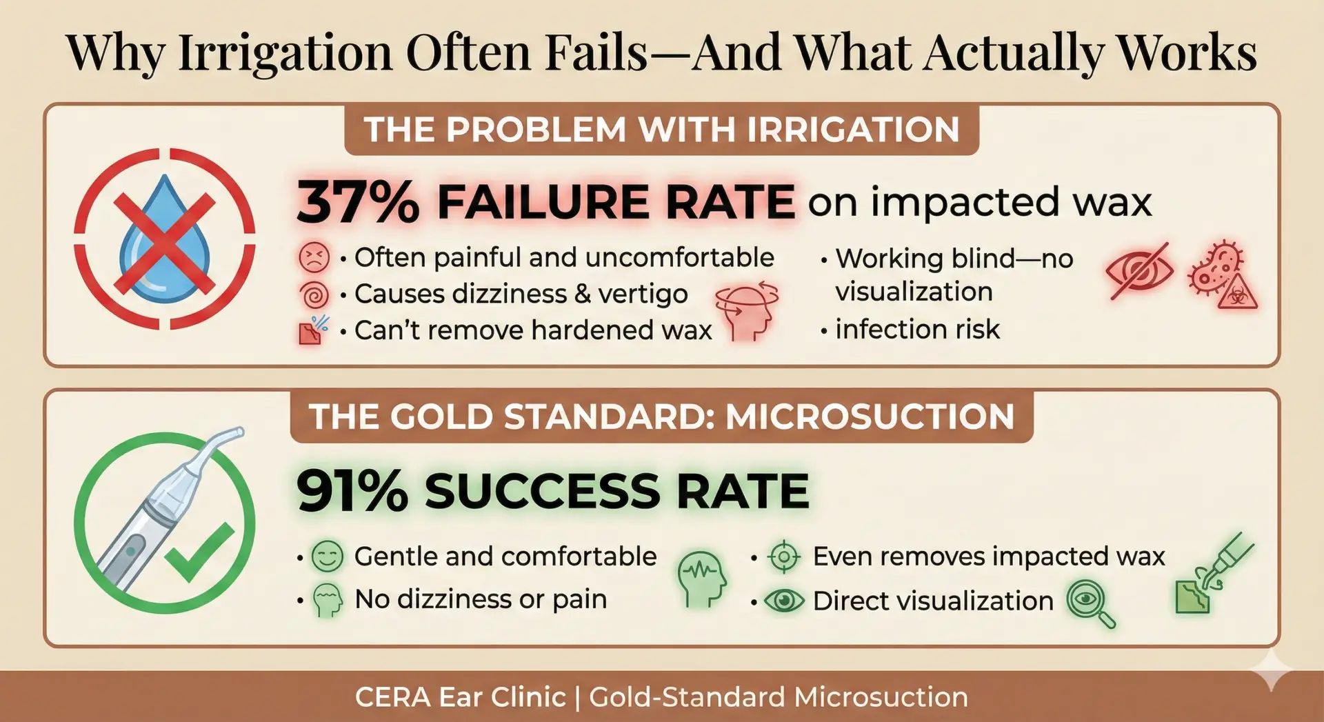 Microsuction is the gold standard for ear wax removal, offering what irrigation cannot: high success rates on impacted wax and a comfortable patient experience. Irrigation fails in 37% of difficult cases, often leaving patients in pain with wax still stuck