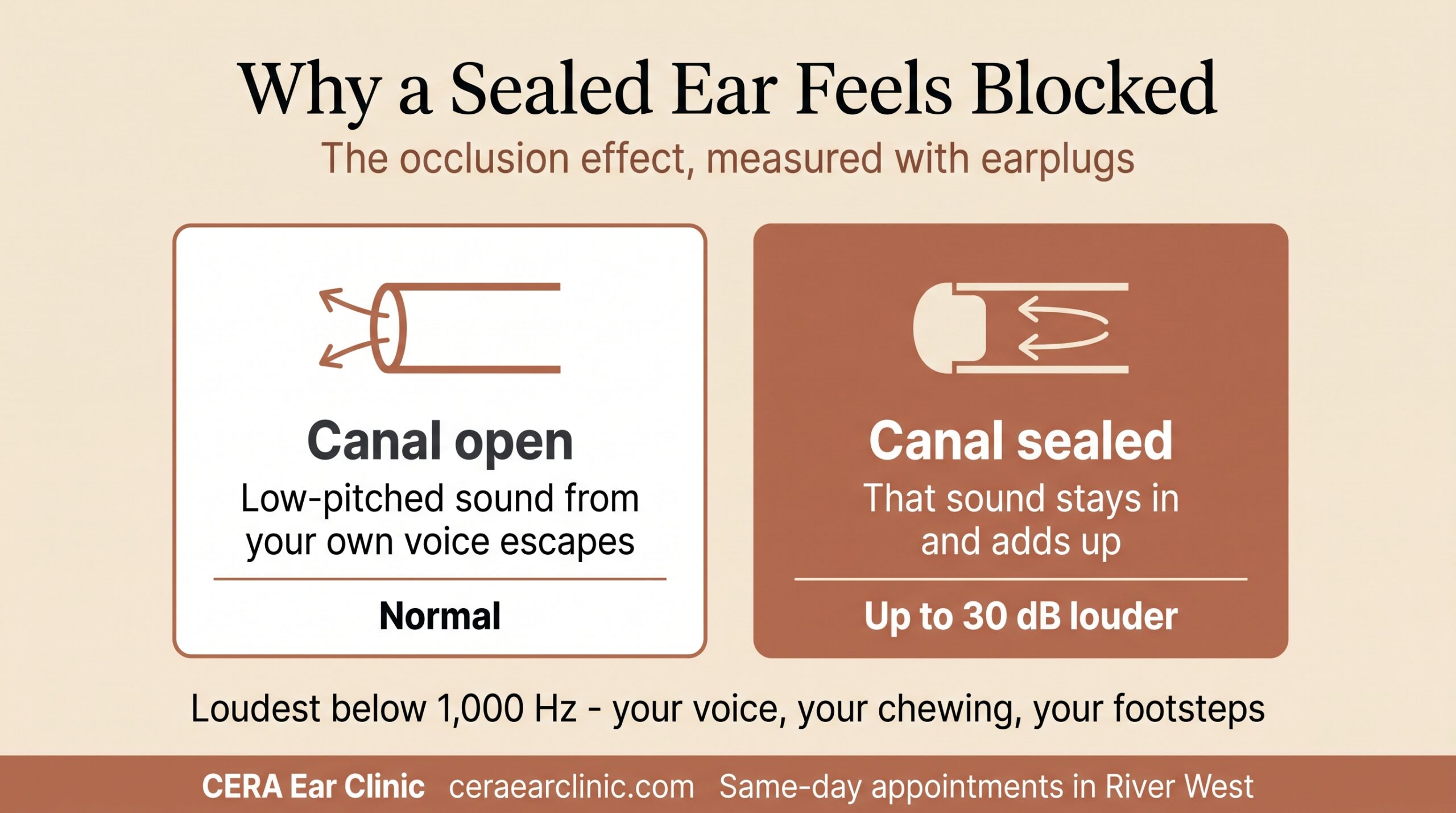 Comparison of an open ear canal, where low-pitched sound escapes, and a sealed ear canal, where it is trapped and up to 30 dB louder. CERA Ear Clinic.
